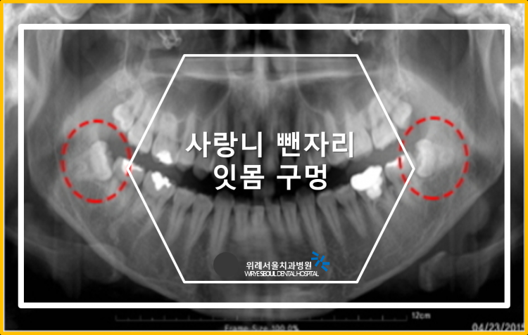14bac6ad94e920be994f864013fa9e64_1635908184_7112.png